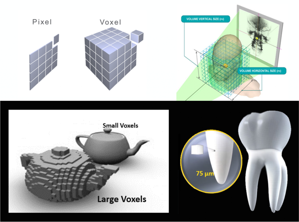 What is a voxel diagram